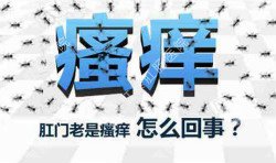 肛門瘙癢治不好嗎？先檢查病因就好辦！